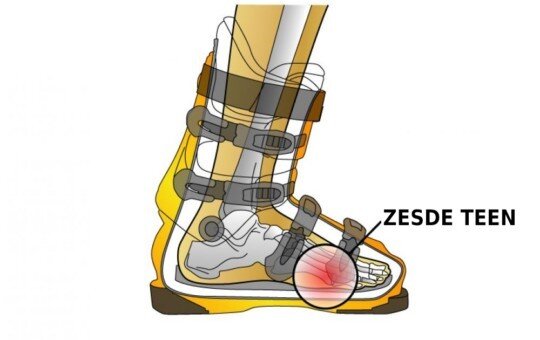 Zesde teen in skischoenen