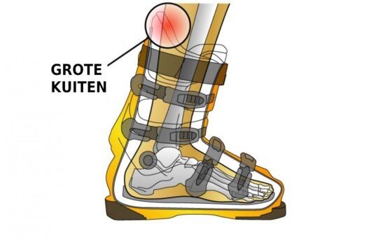 Dikke kuiten skischoenen