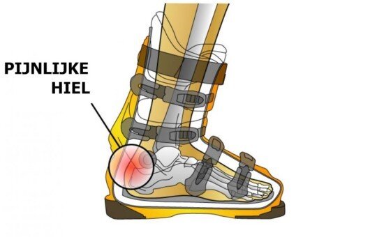 Pijnlijke hiel in skischoen