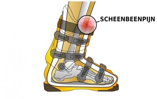 Scheenbeenpijn in skischoenen