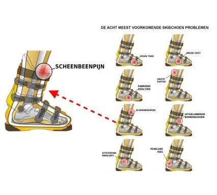 Mauve ongebruikt Transistor Scheenbeenpijn tijdens het skiën. Oorzaak en oplossing. - DutchBootFitter