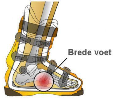 Brede voet in skischoenen